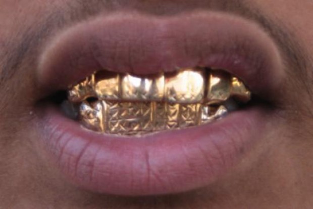 Gouden tanden? an app for that -